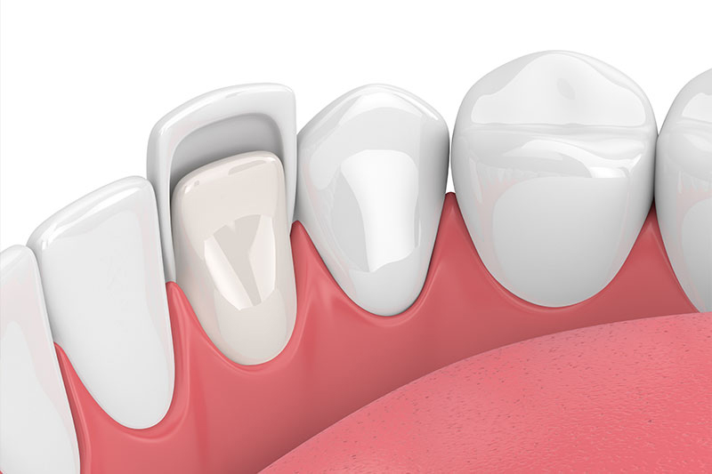 Quality Dental Treatments in Las Vegas