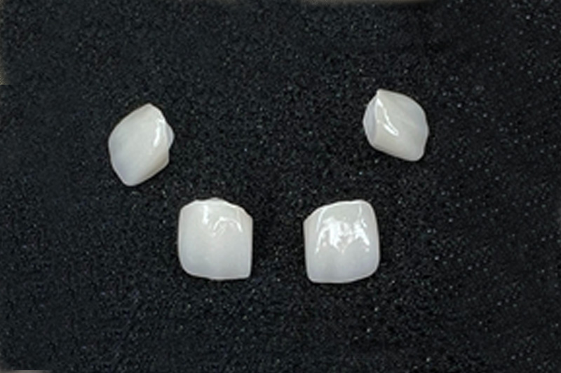 Dental Treatments in Las Vegas